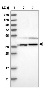 Anti-MRM3 Antibody