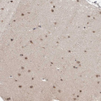 Immunohistochemical staining of human cerebellum shows strong nuclear positivity in cells in molecular layer.