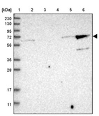 Anti-KLHL26 Antibody