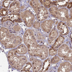 Anti-ZNF618 Antibody