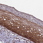 Immunohistochemical staining of human cervix shows strong cytoplasmic positivity in squamous epithelial cells.