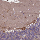 Immunohistochemical staining of human cerebellum shows moderate granular cytoplasmic positivity in Purkinje cells.