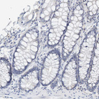 Anti-VSIG8 Antibody