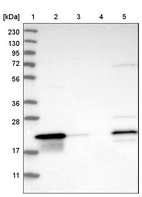 Anti-THEM6 Antibody