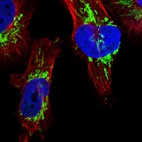 Anti-DSCR3 Antibody