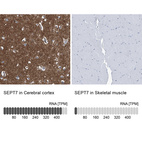 Anti-SEPT7 Antibody