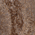 Anti-ZFAND1 Antibody