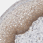 Immunohistochemical staining of human cervix, uterine shows moderate cytoplasmic positivity in squamous epithelial cells.