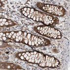 Immunohistochemical staining of human rectum shows strong cytoplasmic positivity in glandular cells.