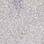 Immunohistochemical staining of human liver shows no positivity in hepatocytes as expected.