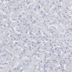 Immunohistochemical staining of human liver shows no cytoplasmic positivity in hepatocytes as expected.