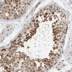 Immunohistochemical staining of human testis shows moderate to strong nuclear positivity in cells in seminiferous ducts.