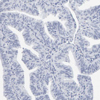 Anti-SPACA3 Antibody