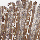 Immunohistochemical staining of human duodenum shows moderate to strong positivity in mitochondria in glandular cells.