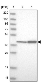 Lane 1: Marker [kDa] 230, 130, 95, 72, 56, 36, 28, 17, 11_br/_Lane 2: Human cell line RT-4_br/_Lane 3: Human cell line U-251MG sp