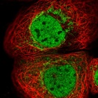 Immunofluorescent staining of human cell line A-431 shows localization to nucleoplasm & mitochondria.