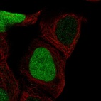 Anti-CDCA5 Antibody