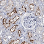 Immunohistochemical staining of human kidney shows high expression.