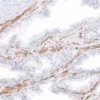 Anti-COL14A1 Antibody