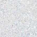 Anti-COL14A1 Antibody