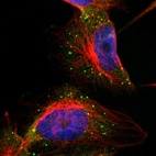 Anti-COL14A1 Antibody