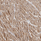 Anti-CHMP4C Antibody