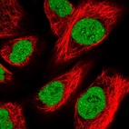 Anti-ZFHX4 Antibody