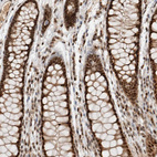 Immunohistochemical staining of human colon shows strong nuclear positivity in glandular cells.