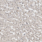 Immunohistochemical staining of human liver shows no positivity in hepatocytes as expected.