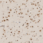 Anti-ZNF683 Antibody