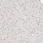 Anti-ZNF683 Antibody