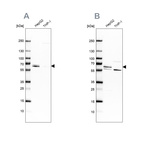 Anti-CDR2 Antibody