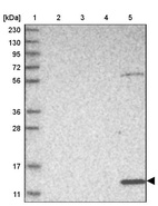 Lane 1: Marker [kDa] 230, 130, 95, 72, 56, 36, 28, 17, 11_br/_Lane 2: Human cell line RT-4_br/_Lane 3: Human cell line U-251MG sp_br/_Lane 4: Human plasma (IgG/HSA depleted)_br/_Lane 5: Human liver tissue