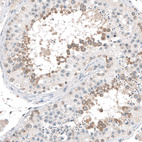 Anti-CEP131 Antibody