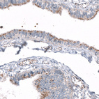 Anti-CEP131 Antibody