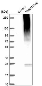 Anti-TMEM184B Antibody