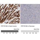 Anti-PPP1R12B Antibody