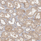 Anti-NXT2 Antibody