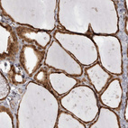 Anti-SZRD1 Antibody