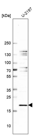 Anti-SZRD1 Antibody