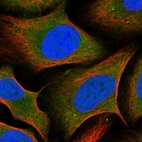 Anti-SZRD1 Antibody