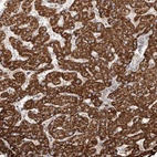 Anti-WDR91 Antibody