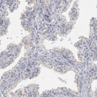 Immunohistochemical staining of human prostate shows very weak positivity in glandular cells.