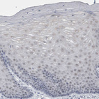 Immunohistochemical staining of human cervix, uterine shows no positivity in squamous epithelial cells as expected