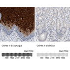 Anti-CRNN Antibody