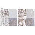 Anti-SMARCC1 Antibody