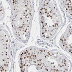 Anti-SMARCC1 Antibody