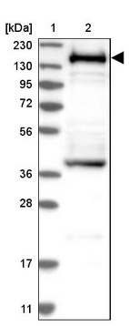 Anti-SMARCC1 Antibody