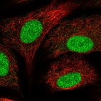 Anti-SNAPC5 Antibody