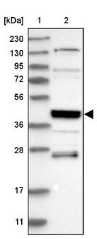 Anti-SMAP2 Antibody